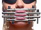Фиксатор для губ и языка Stainless Steel Lips and Tongue Press